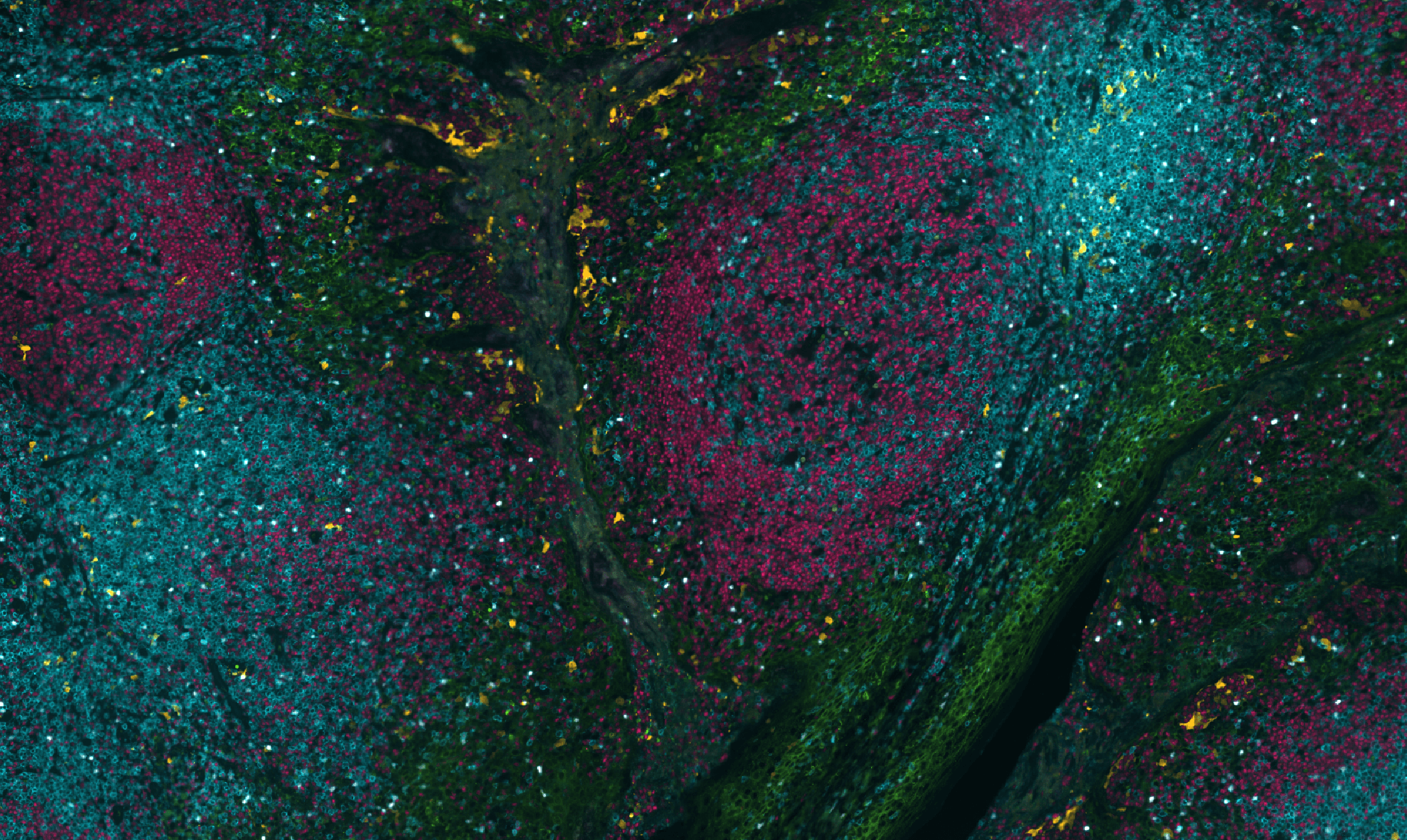 Multiplex immunofluorescence image